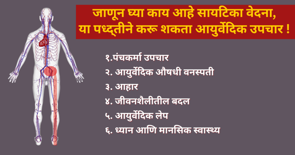 सायटिका