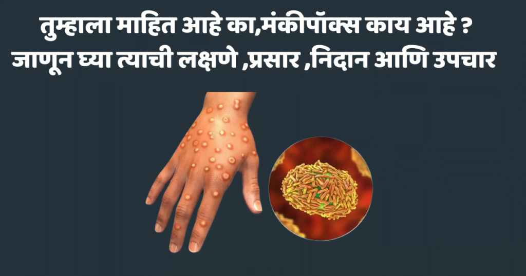 monkeypox india