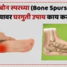Bone Spurs in Feet