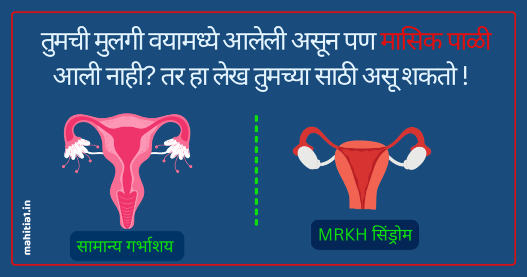 MRKH syndrome
