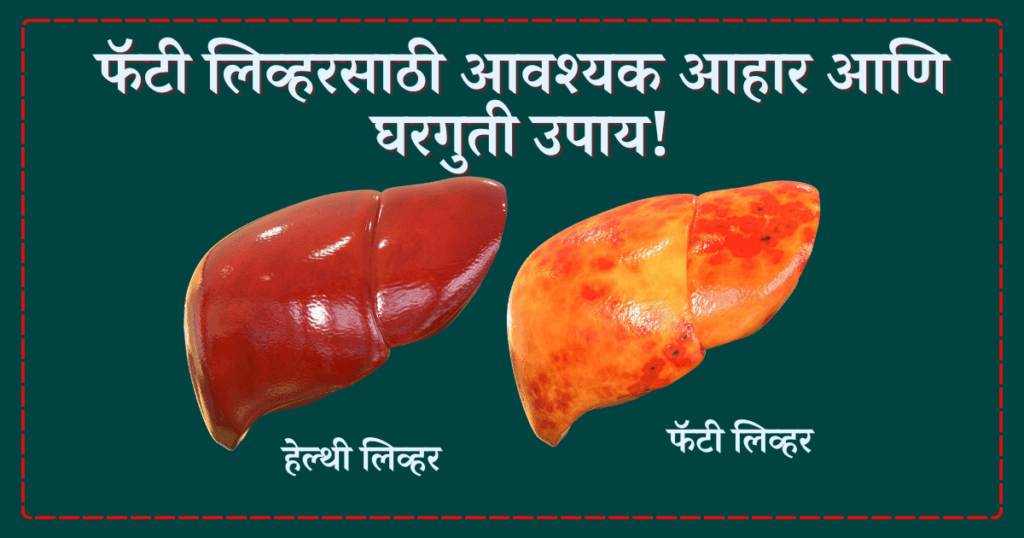 fatty liver