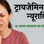 ट्रायजेमिनल न्यूराल्जिया म्हणजे काय?